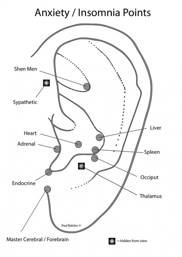 Insomnia Ear Points
